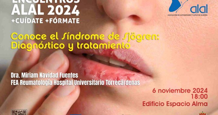 Charla Síndrome de SJögren